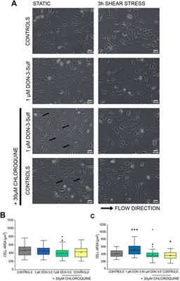 Endoplasmic Reticulum Adaptation and Autophagic Competence Shape Response to Fluid Shear Stress in T24 Bladder Cancer Cells